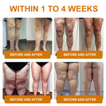 AbSculpt™