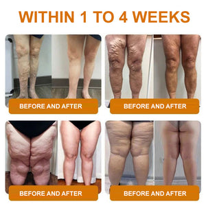 AbSculpt™